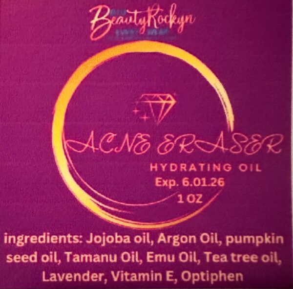 Acne oil - Image 2